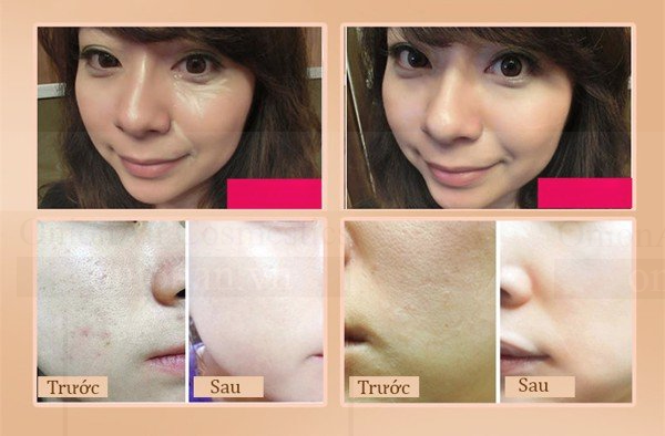 Kem Nền Chống Nắng Ốc Sên Anjo Natural Cover Snail Sun BB SPF50+ PA+++